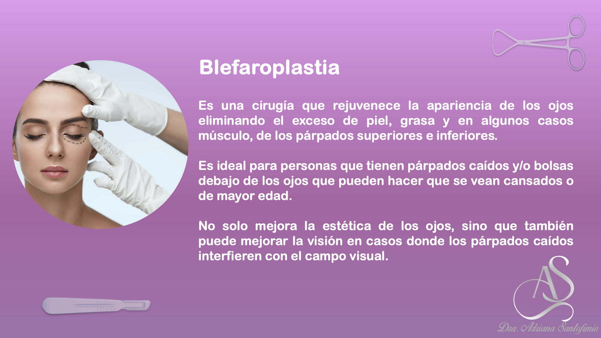 Blefaroplastia
