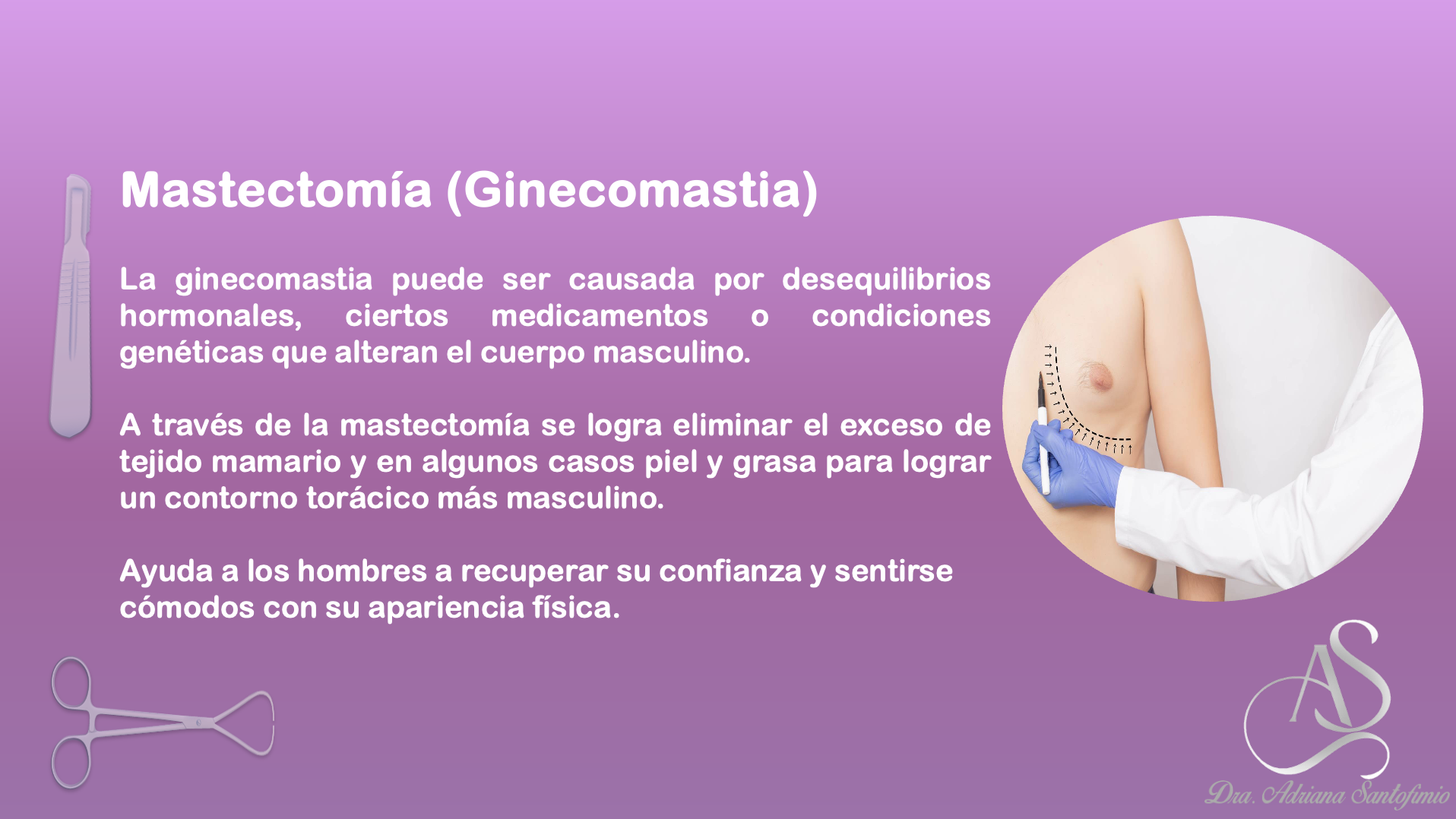 Mastectomia - Ginecomastia