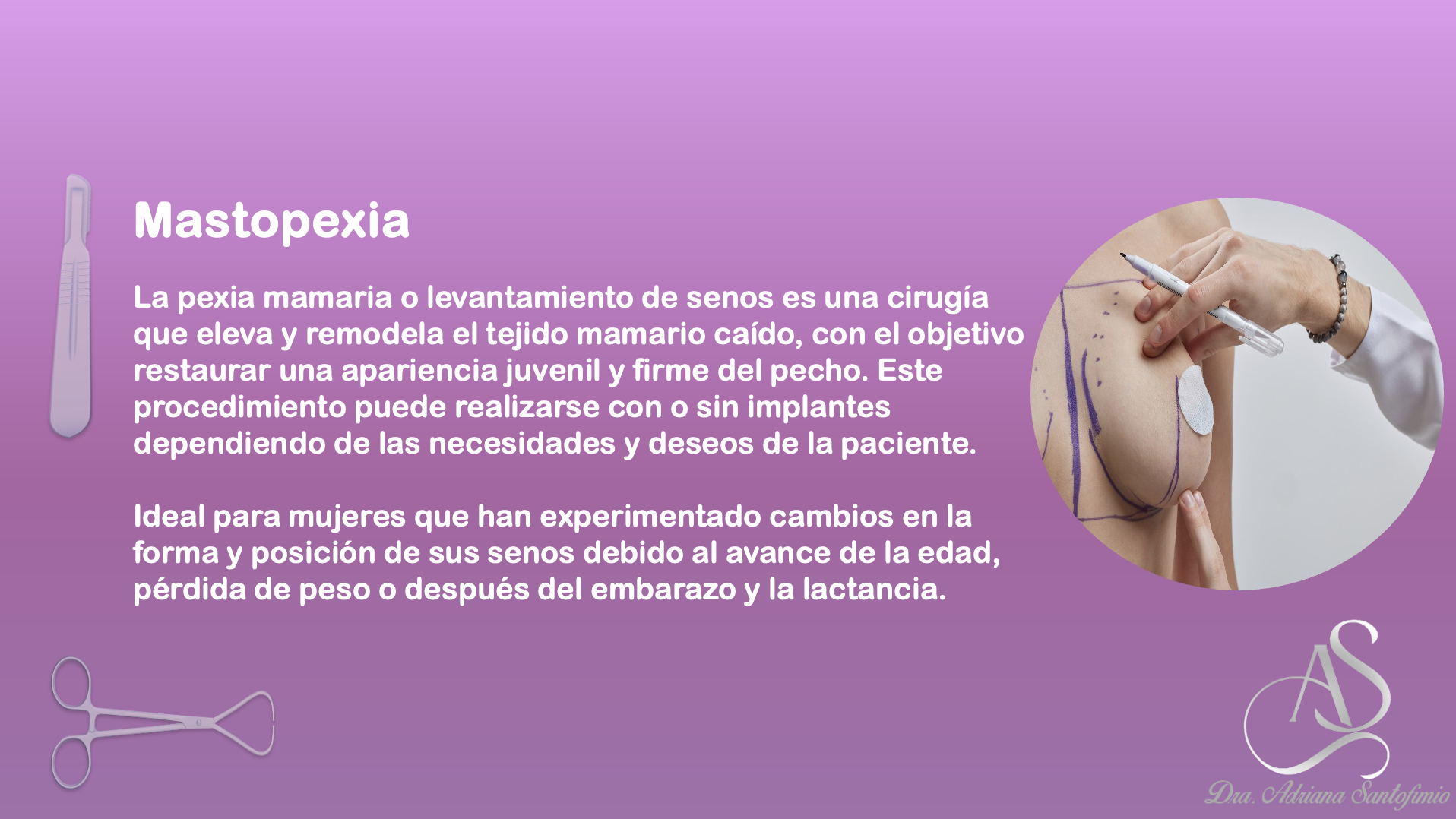Mastopexia (1)